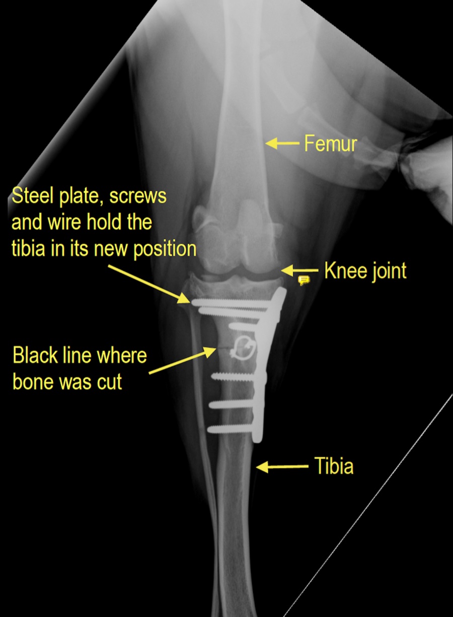 Post-op CrCa annotated