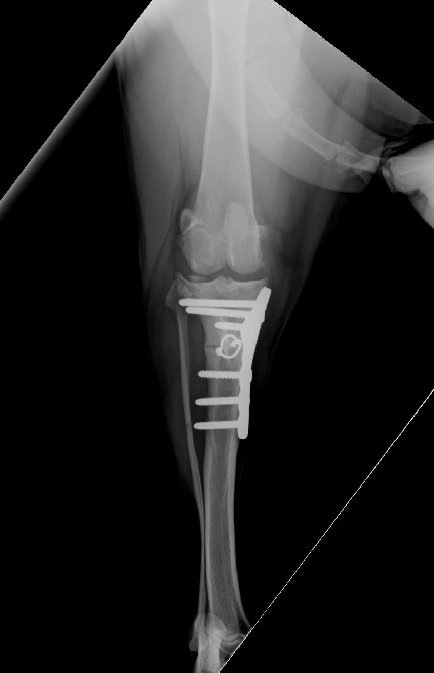 Post-op CrCa view