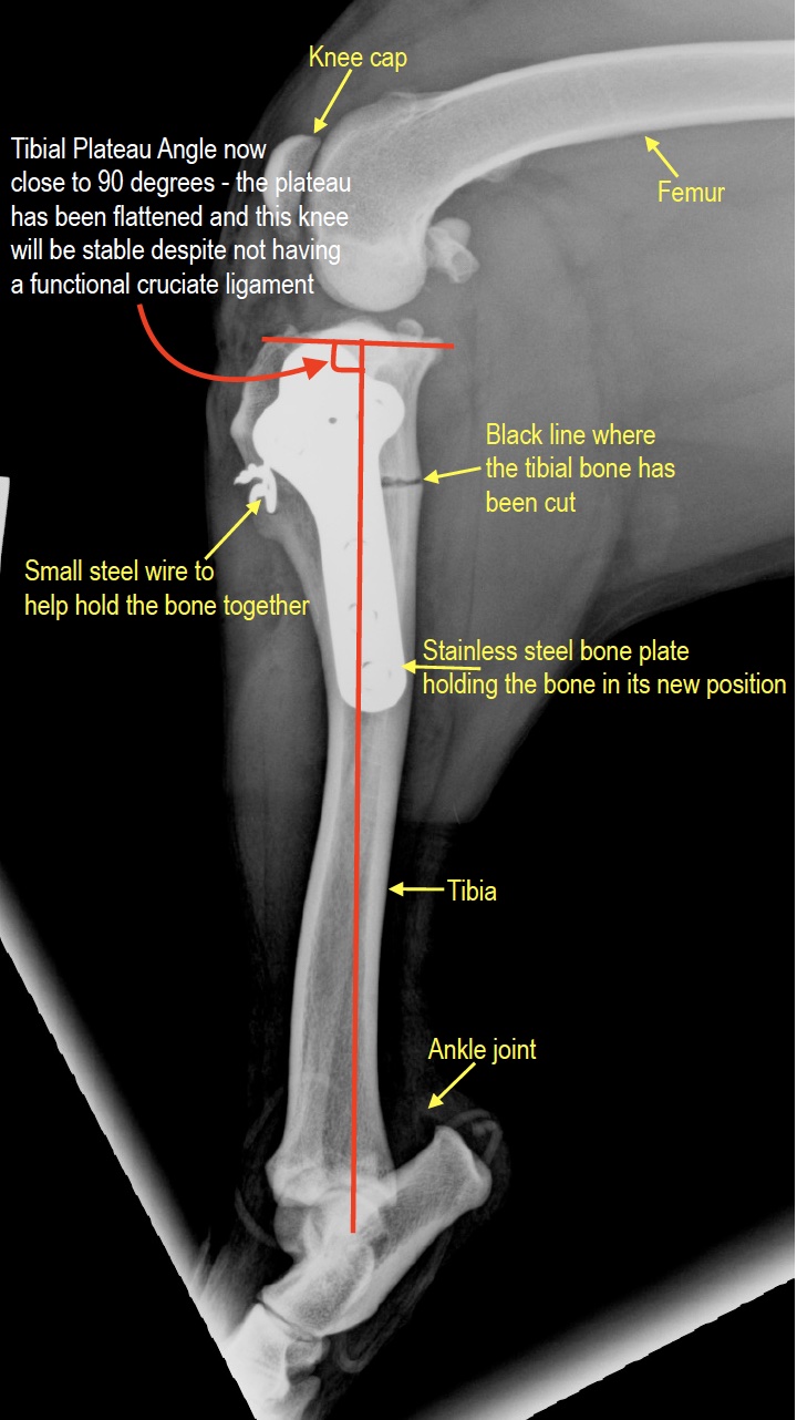 Post-op ML annotated