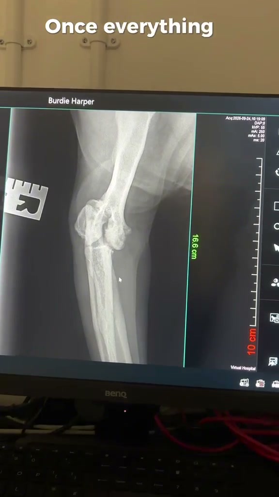 Burdie x-ray