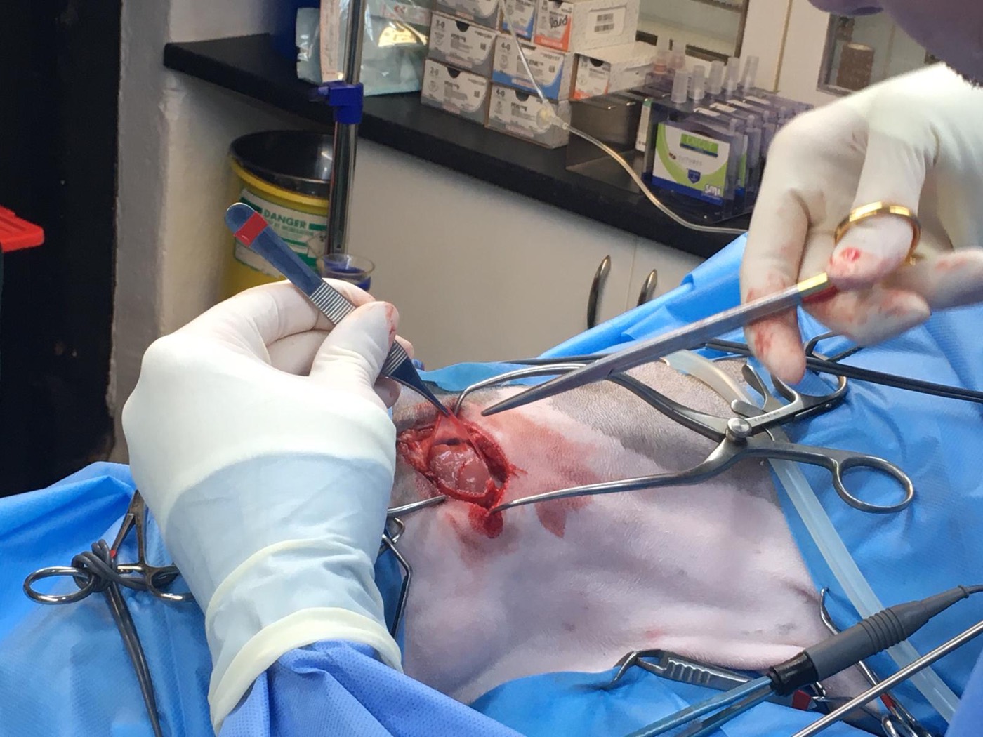 Chase surgery photo 2
