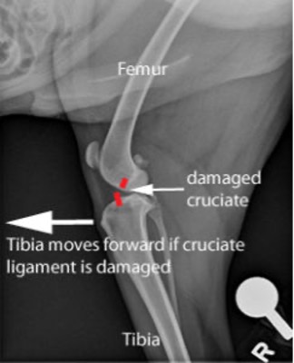 Diagram showing tibia moving forward when the cruciate ligament is damaged