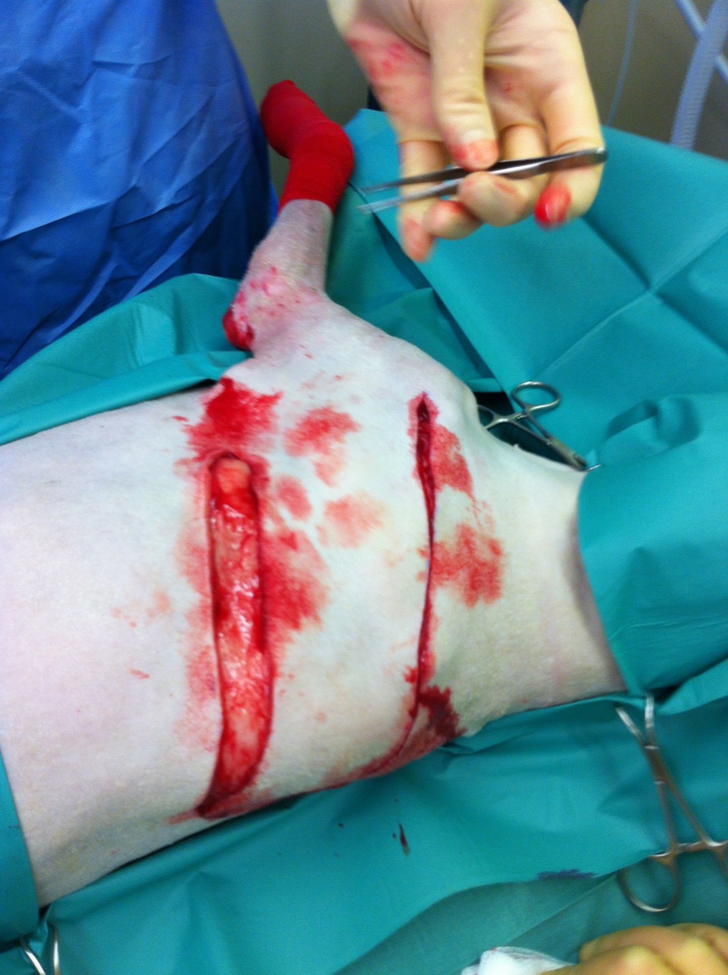 Eddie surgery photo 2
