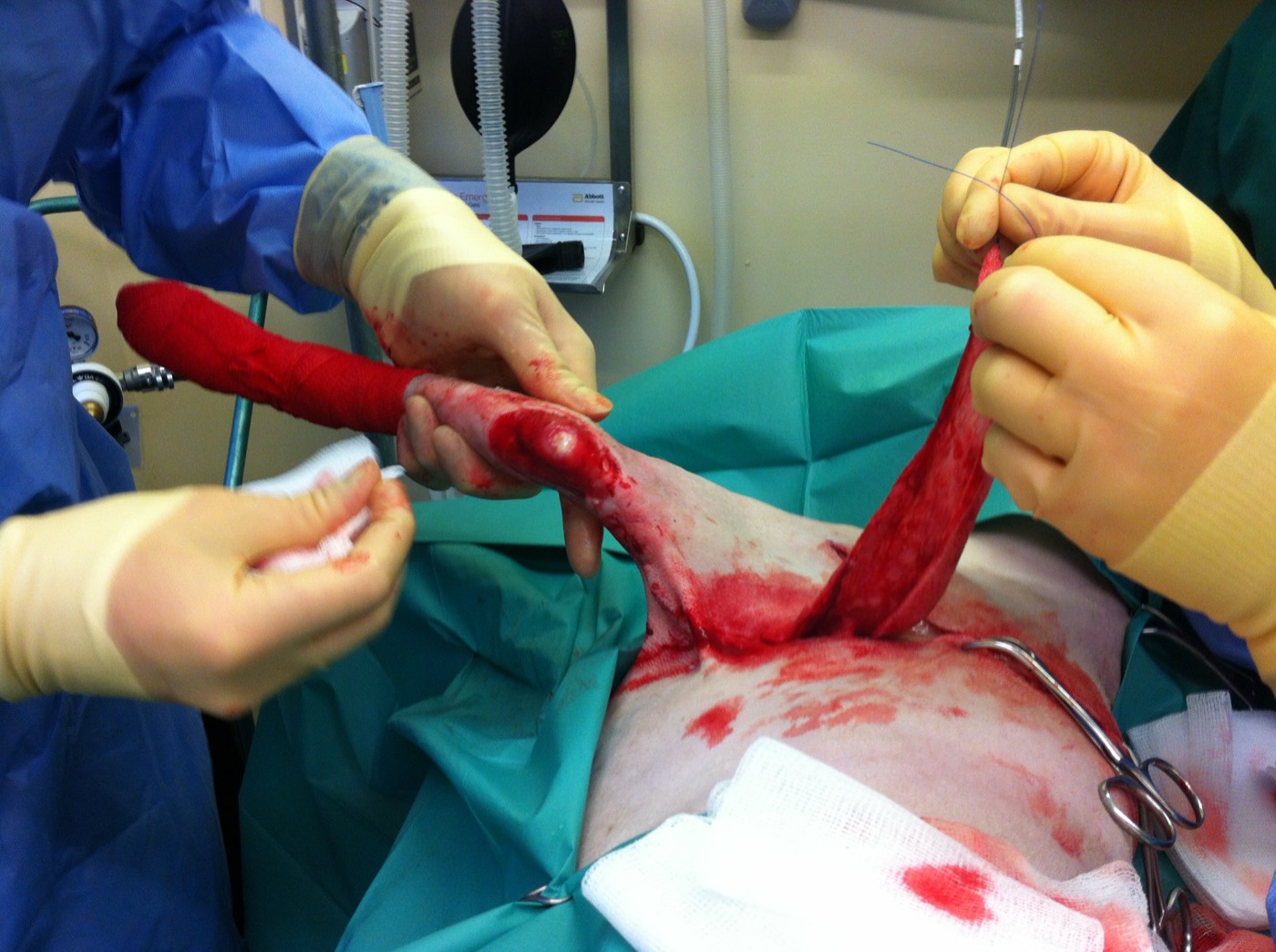 Eddie surgery photo 3