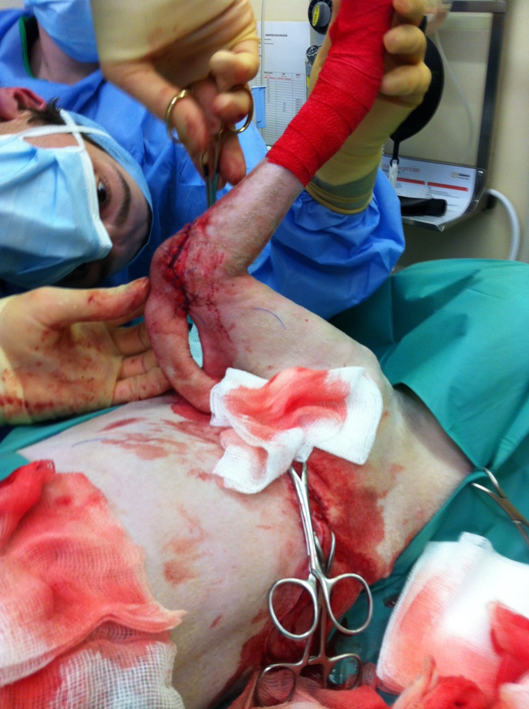 Eddie surgery photo 4