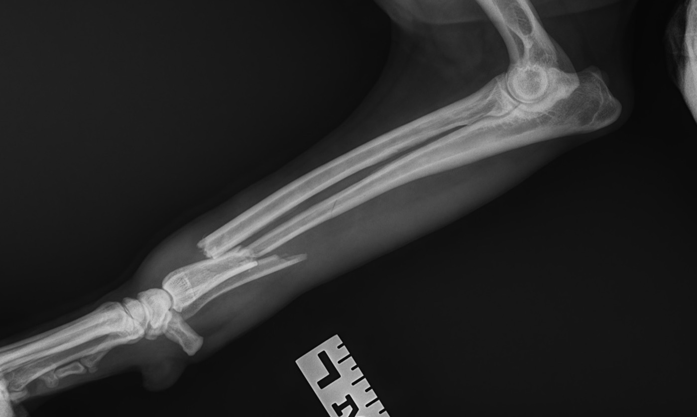 Henry x-ray 1