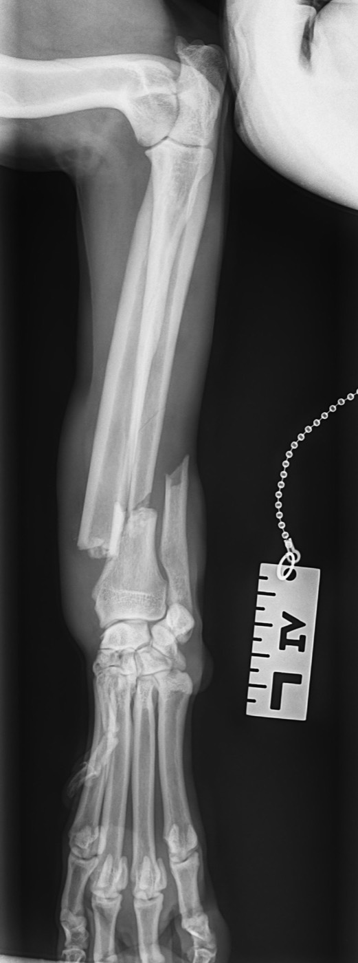 Henry x-ray 4