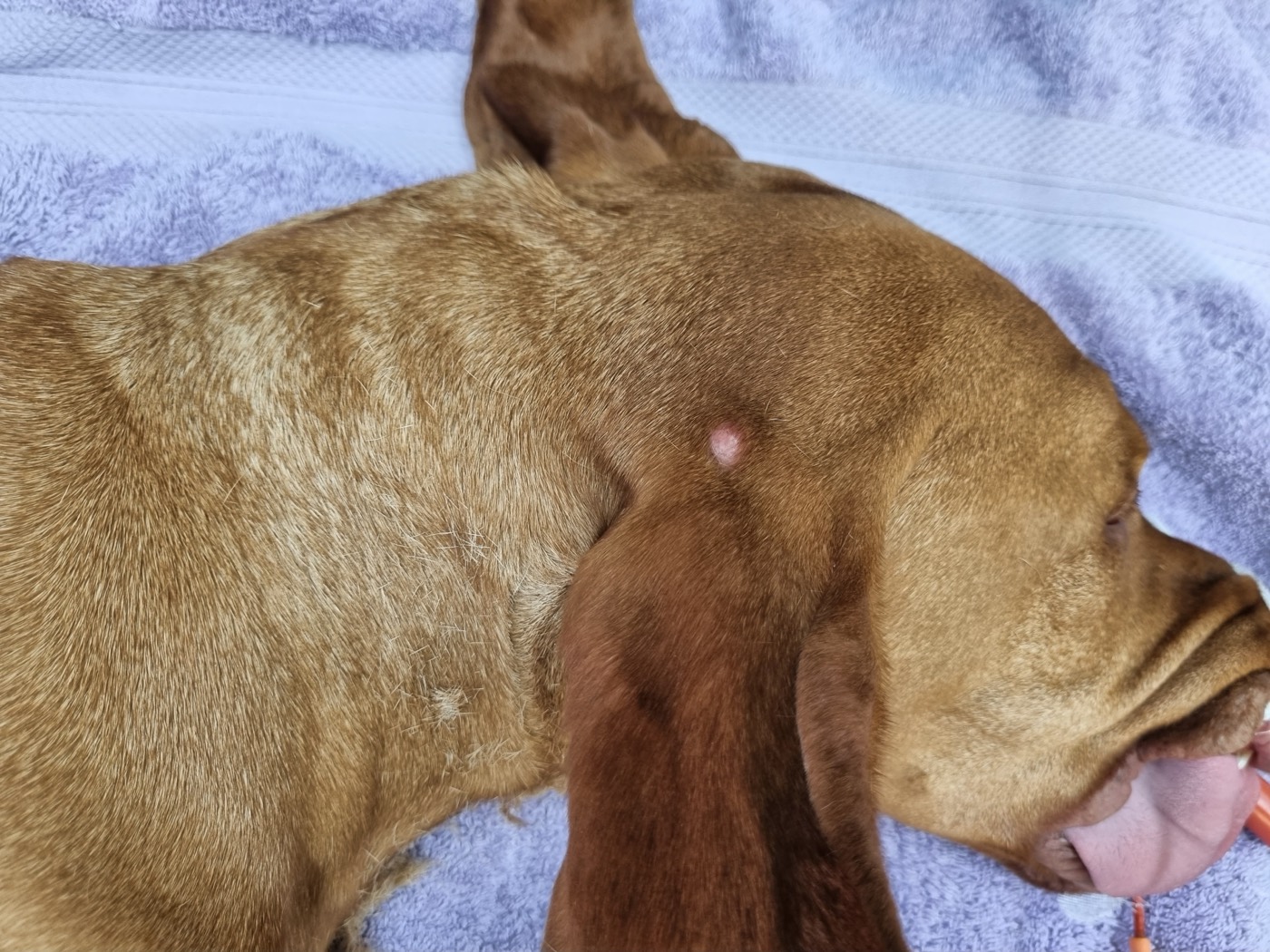 Hunter surgery photo 1