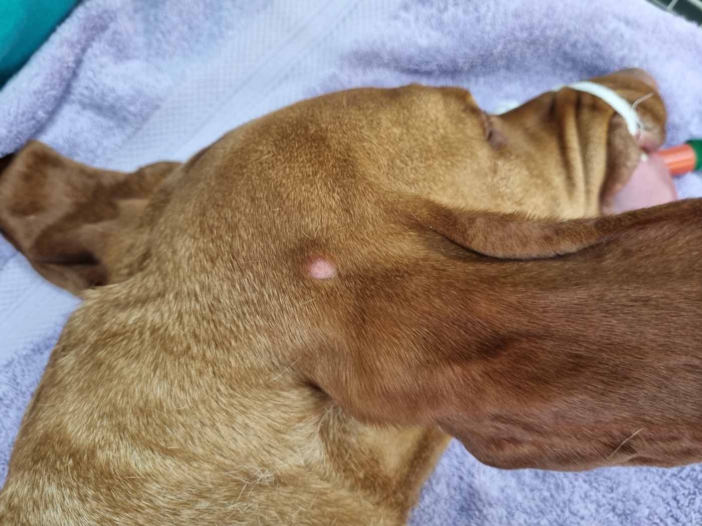 Hunter surgery photo 2
