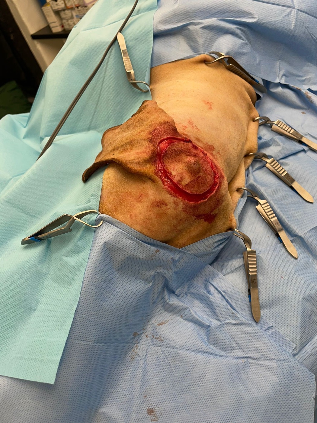 Hunter surgery photo 3