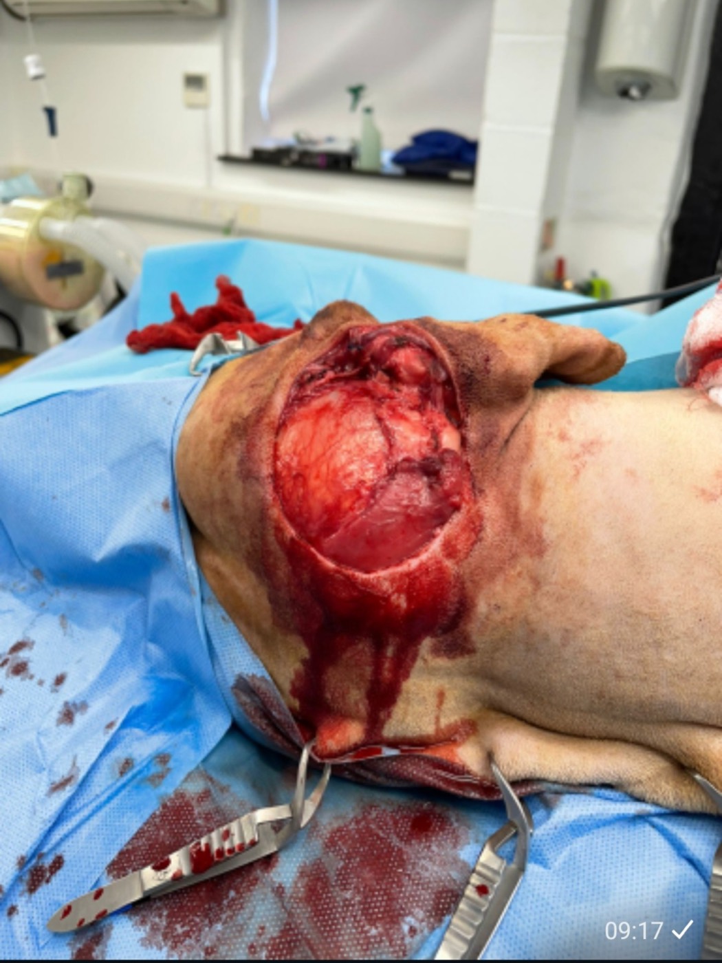 Hunter surgery photo 4