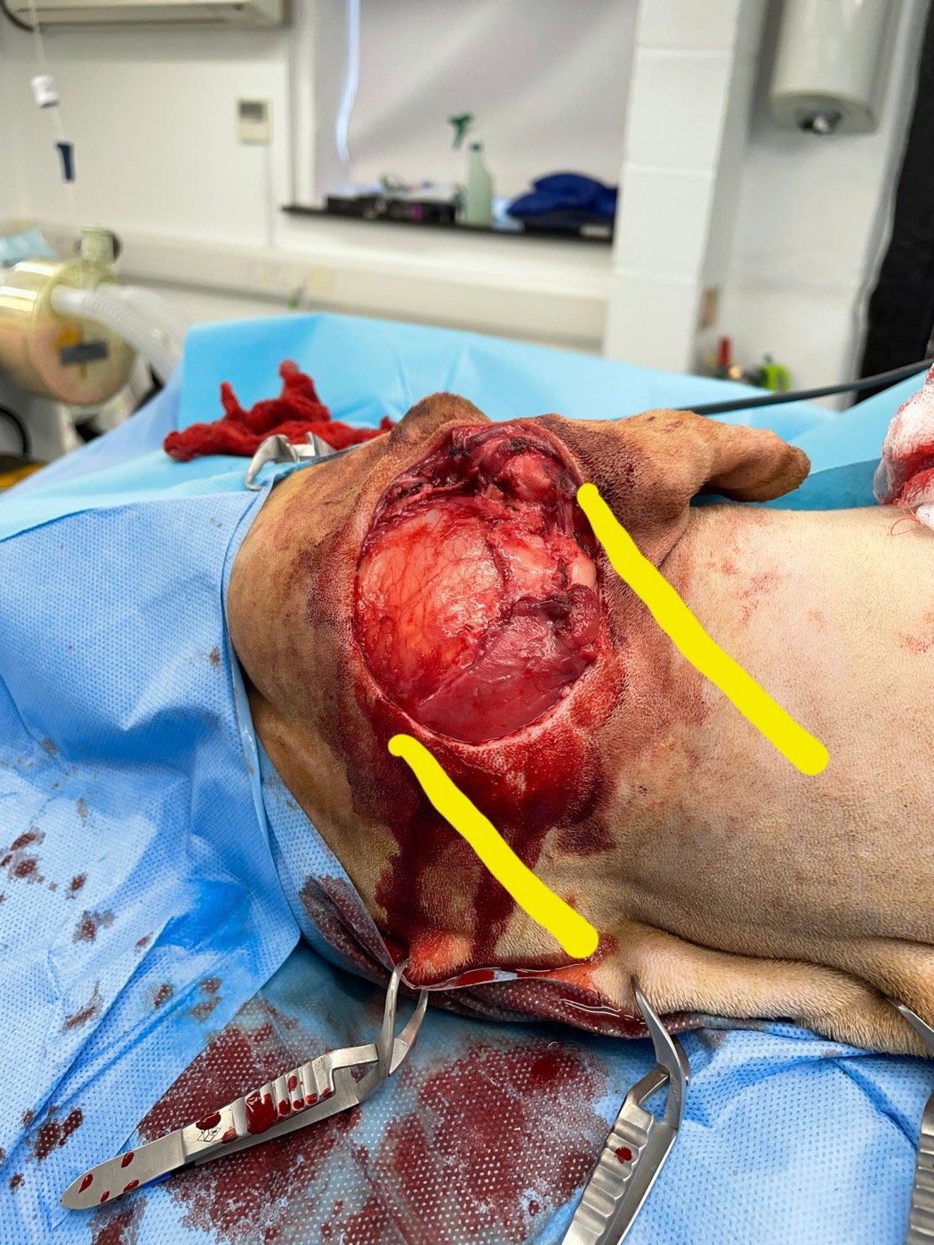 Hunter surgery photo 5