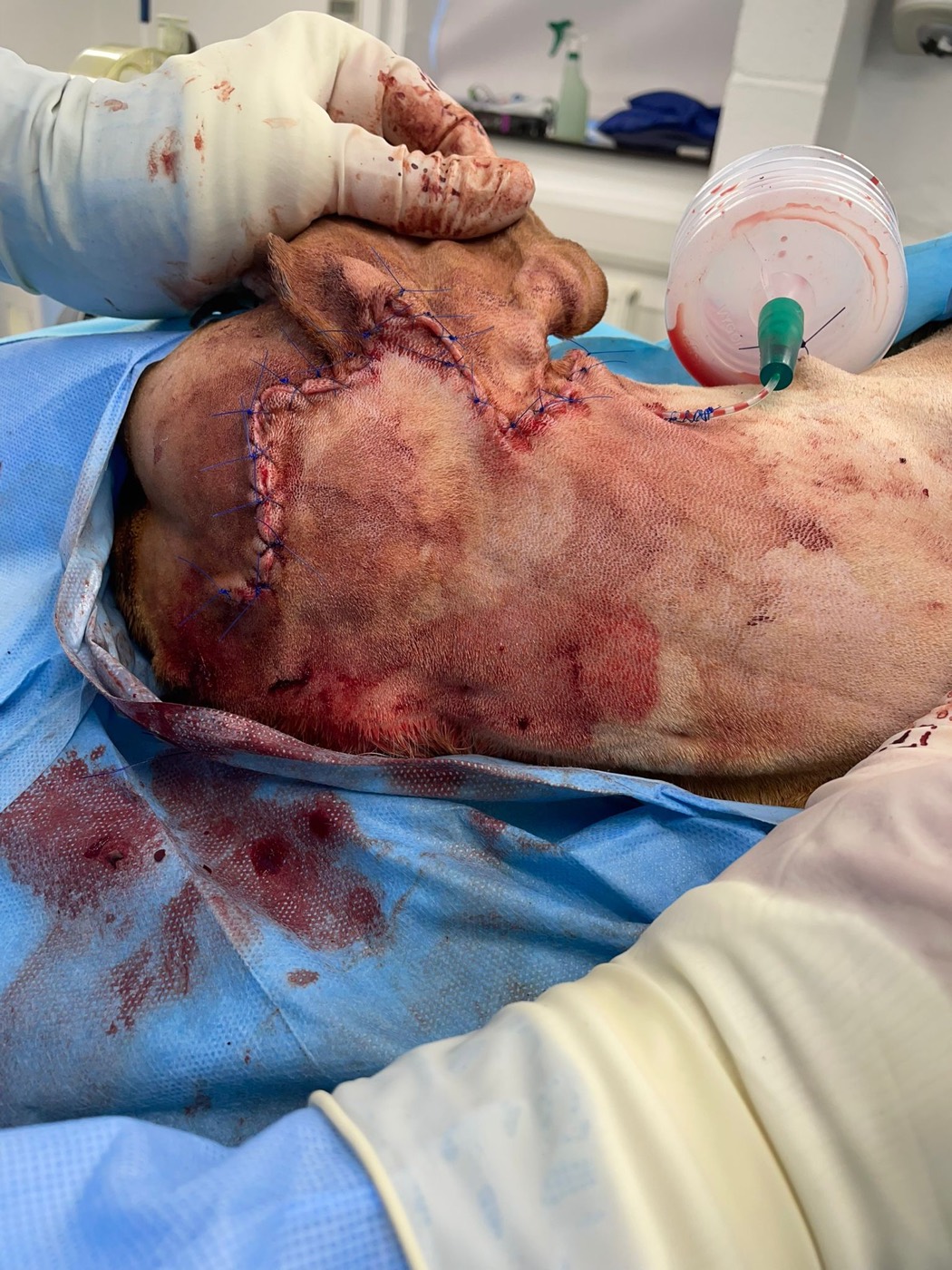 Hunter surgery photo 6