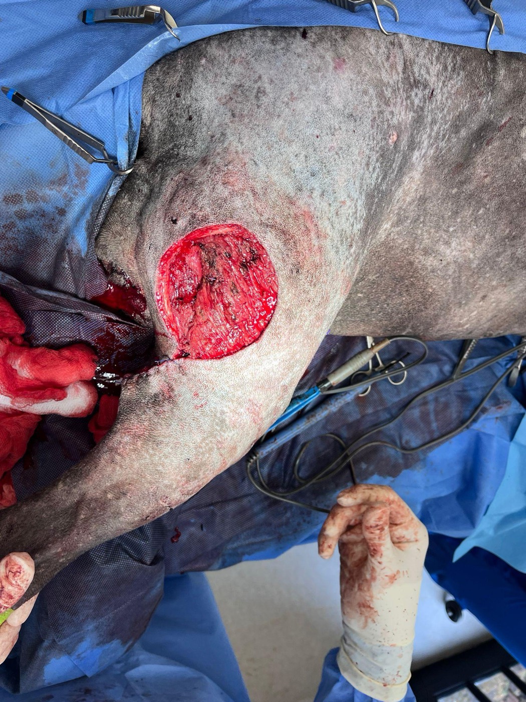 Luna surgery photo
