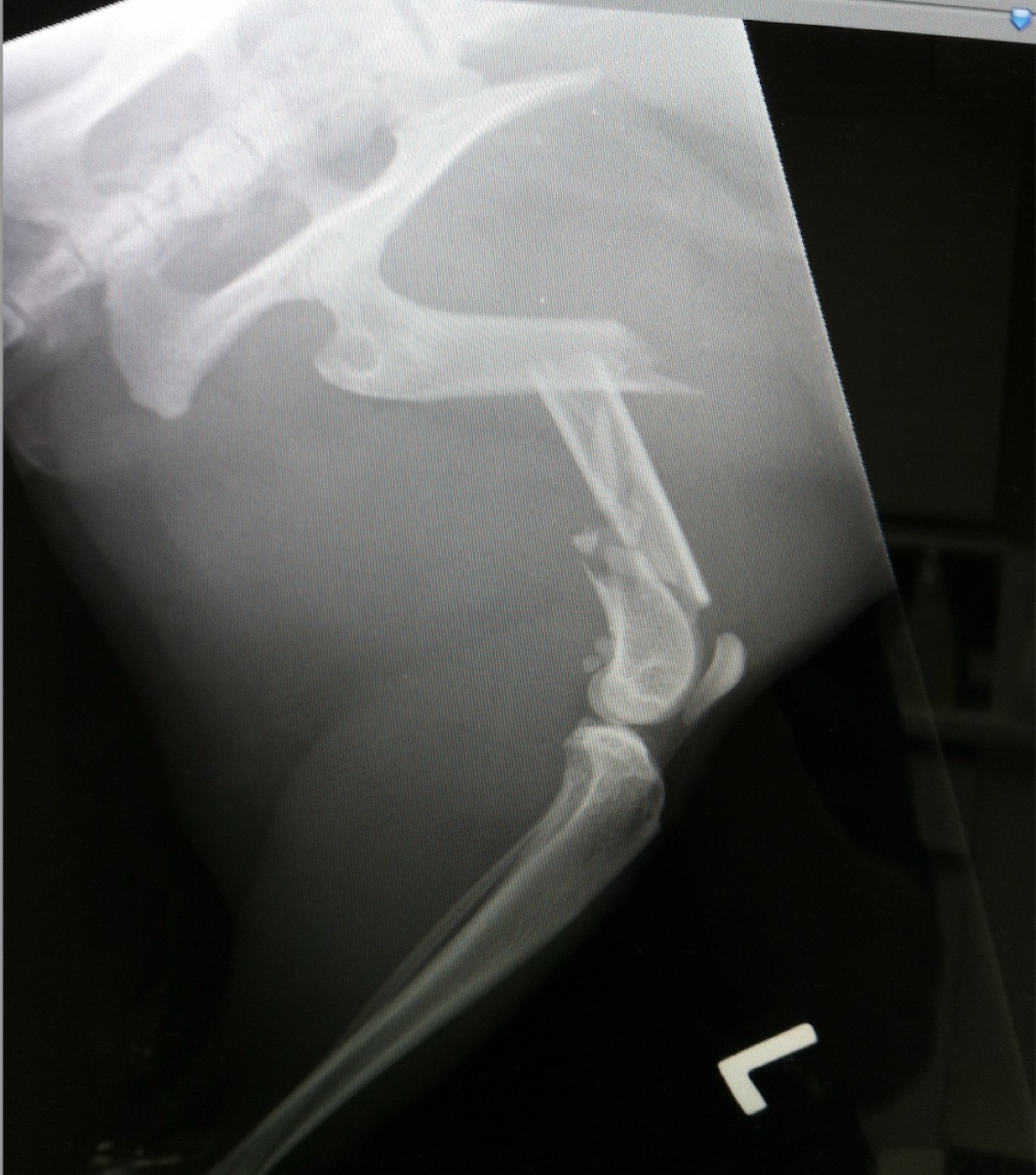 Niven x-ray 2