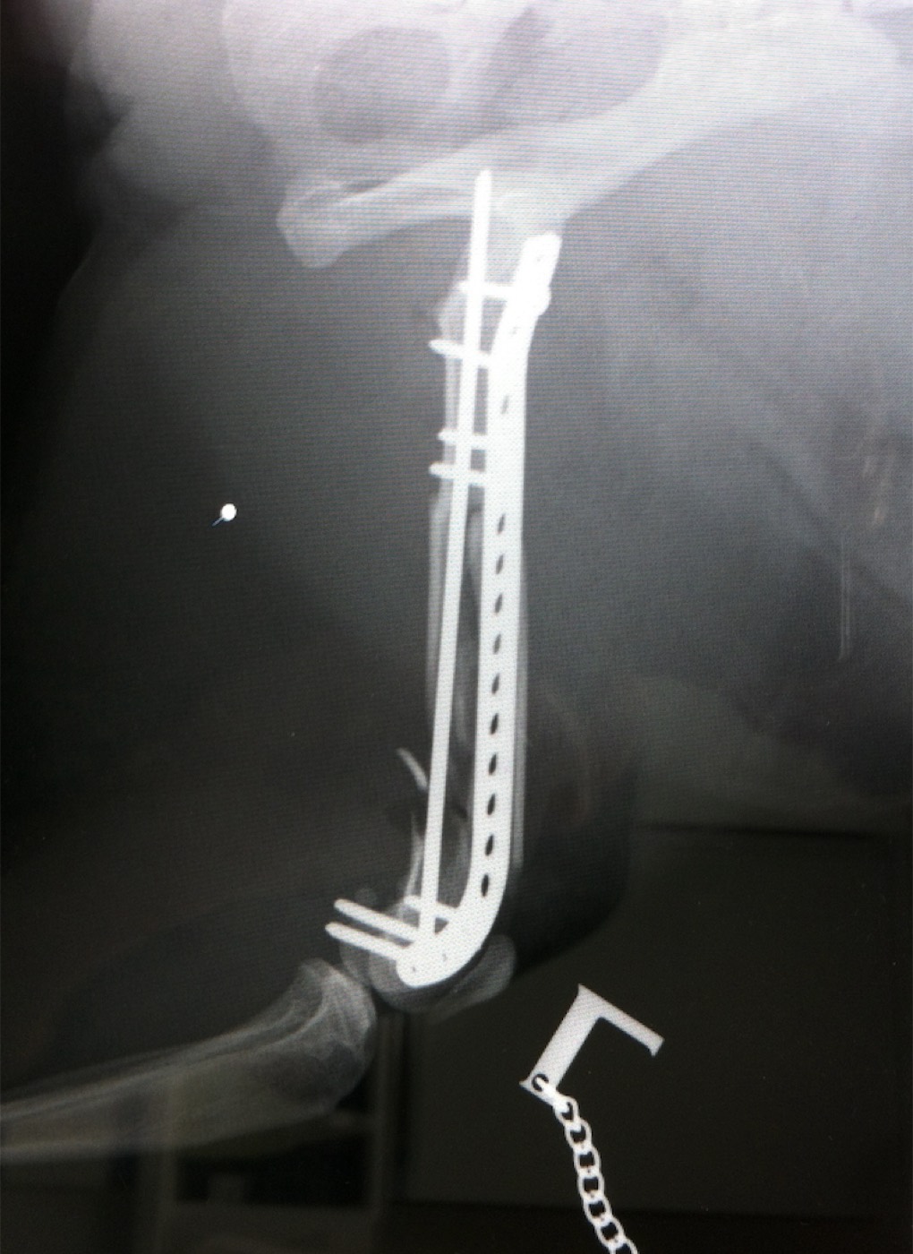 Niven x-ray 3