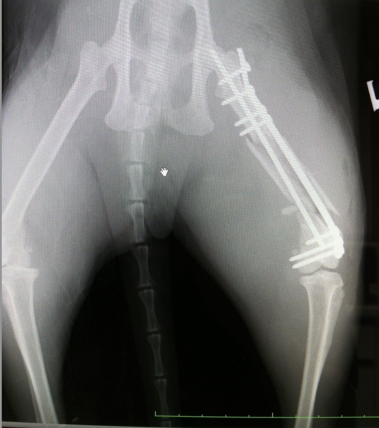 Niven x-ray 4